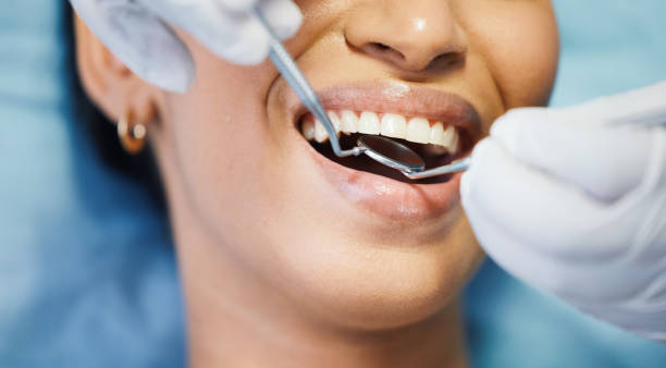 Best Broken or Cracked Tooth Emergency Dentist in Riesel, TX