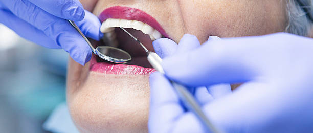 Best Emergency Dentist for Knocked-Out Tooth in Riesel, TX